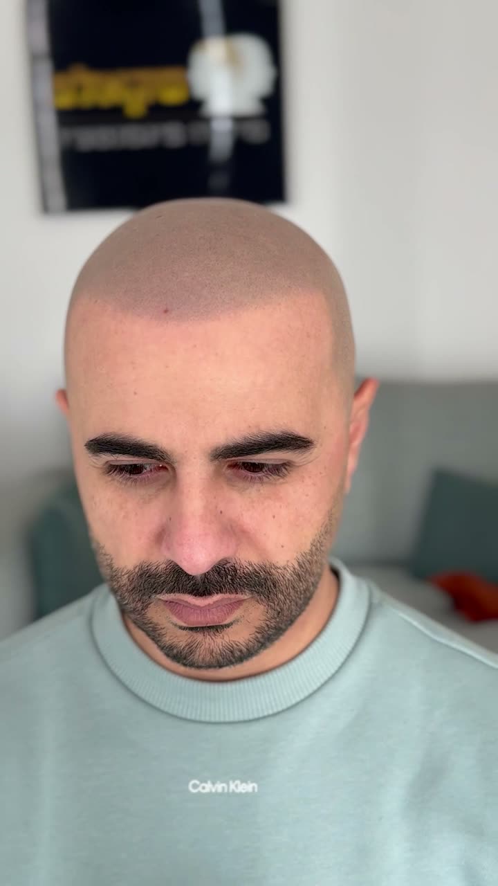 אותו לקוח אחרי הטיפול