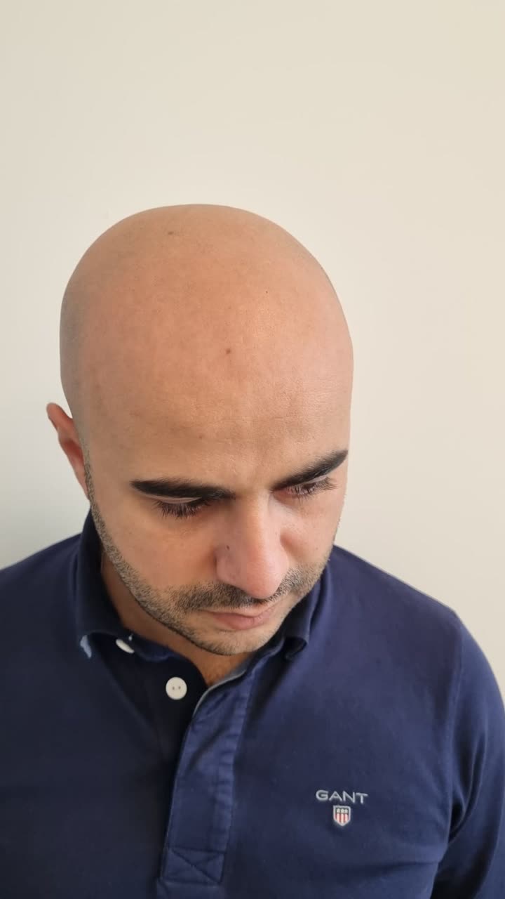 לקוח לפני הטיפול