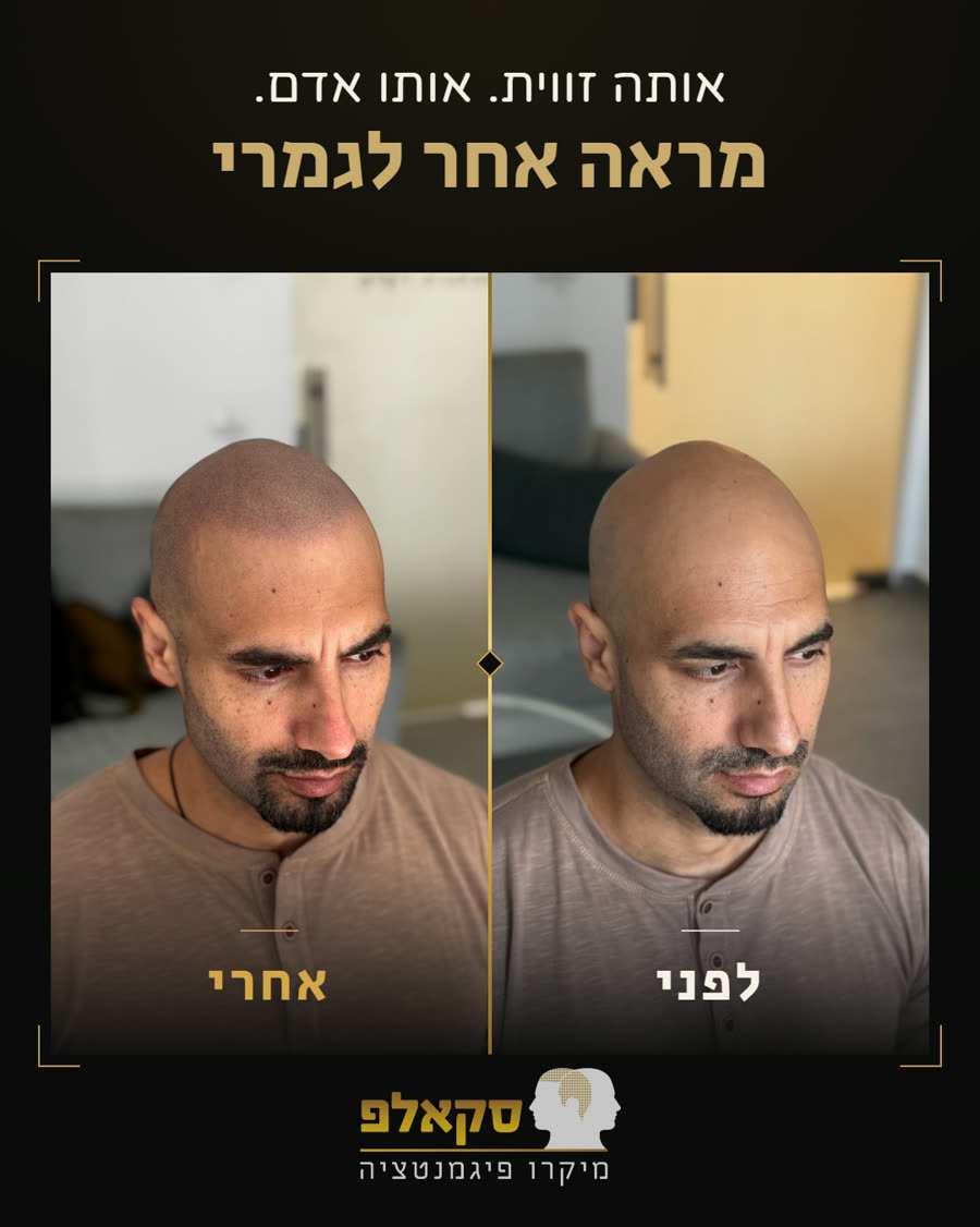 לפני ואחרי: אותה זווית, אותו אדם