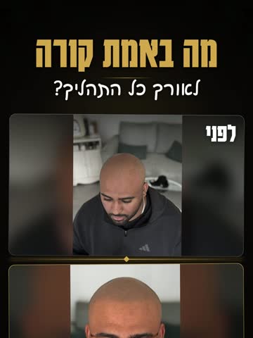 ריל: מה באמת קורה לאורך התהליך