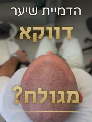 ריל: למה הדמיית שיער