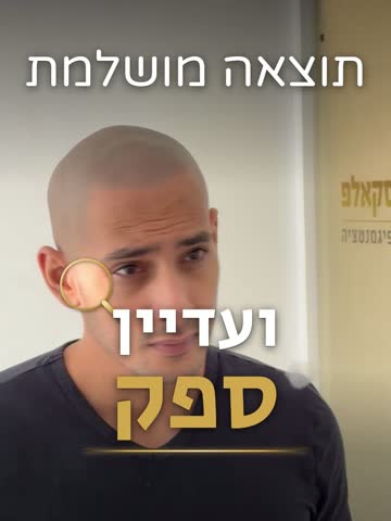 ריל: תוצאה מושלמת ועדיין ספק